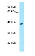 GPR78 Antibody - GPR78 antibody Western Blot of Fetal kidney.  This image was taken for the unconjugated form of this product. Other forms have not been tested.