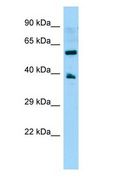 GPR78 Antibody - GPR78 antibody Western Blot of OVCAR-3.  This image was taken for the unconjugated form of this product. Other forms have not been tested.