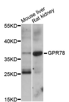 GPR78 Antibody - Western blot analysis of extracts of various cell lines, using GPR78 antibody at 1:1000 dilution. The secondary antibody used was an HRP Goat Anti-Rabbit IgG (H+L) at 1:10000 dilution. Lysates were loaded 25ug per lane and 3% nonfat dry milk in TBST was used for blocking. An ECL Kit was used for detection and the exposure time was 30s.
