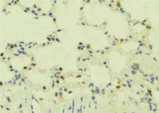 GPR78 Antibody - 1:100 staining mouse lung tissue by IHC-P. The sample was formaldehyde fixed and a heat mediated antigen retrieval step in citrate buffer was performed. The sample was then blocked and incubated with the antibody for 1.5 hours at 22°C. An HRP conjugated goat anti-rabbit antibody was used as the secondary.