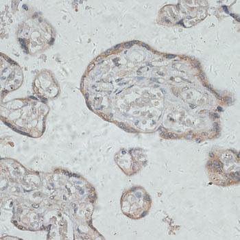 GPR78 Antibody - Immunohistochemistry of paraffin-embedded Human placenta using GPR78 Polyclonal Antibody at dilution of 1:100 (40x lens).