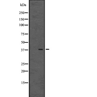 GPR80 / GPR99 / OXGR1 Antibody - Western blot analysis of GPR80/GPR99 expression in human placenta tissue lysates. The lane on the left is treated with the antigen-specific peptide.