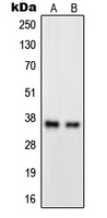 GPR82 Antibody - Western blot analysis of GPR82 expression in A549 (A); HeLa (B) whole cell lysates.