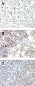 GPR83 Antibody - IHC of frozen brain (neurons & glia, image A), frozen tonsil tissue (lymphocytes, image B), and formalin-fixed paraffin embedded tonsil tissue (image c) using antibody at 20 ug/ml.