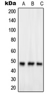 GPR83 Antibody - Western blot analysis of GPR83 expression in HeLa (A); Jurkat (B); HUVEC (C) whole cell lysates.