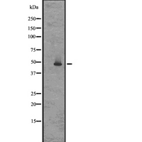 GPR83 Antibody - Western blot analysis of GPR83/GPR72 expression in rat brain lysates in RIPA buffer;developed using the ECL technique. The lane on the left is treated with the antigen-specific peptide.