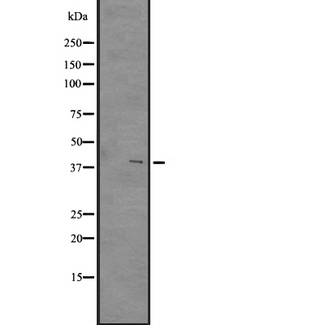 GPR84 Antibody - Western blot analysis of GPR84 expression in A431 whole cells lysate. The lane on the left is treated with the antigen-specific peptide.