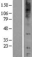 GPR84 Protein - Western validation with an anti-DDK antibody * L: Control HEK293 lysate R: Over-expression lysate