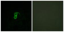 GPR87 Antibody - Immunofluorescence analysis of HUVEC cells, using GPR87 Antibody. The picture on the right is blocked with the synthesized peptide.