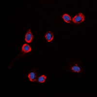 GPR87 Antibody - Immunofluorescent analysis of GPR87 staining in HUVEC cells. Formalin-fixed cells were permeabilized with 0.1% Triton X-100 in TBS for 5-10 minutes and blocked with 3% BSA-PBS for 30 minutes at room temperature. Cells were probed with the primary antibody in 3% BSA-PBS and incubated overnight at 4 deg C in a humidified chamber. Cells were washed with PBST and incubated with a DyLight 594-conjugated secondary antibody (red) in PBS at room temperature in the dark. DAPI was used to stain the cell nuclei (blue).