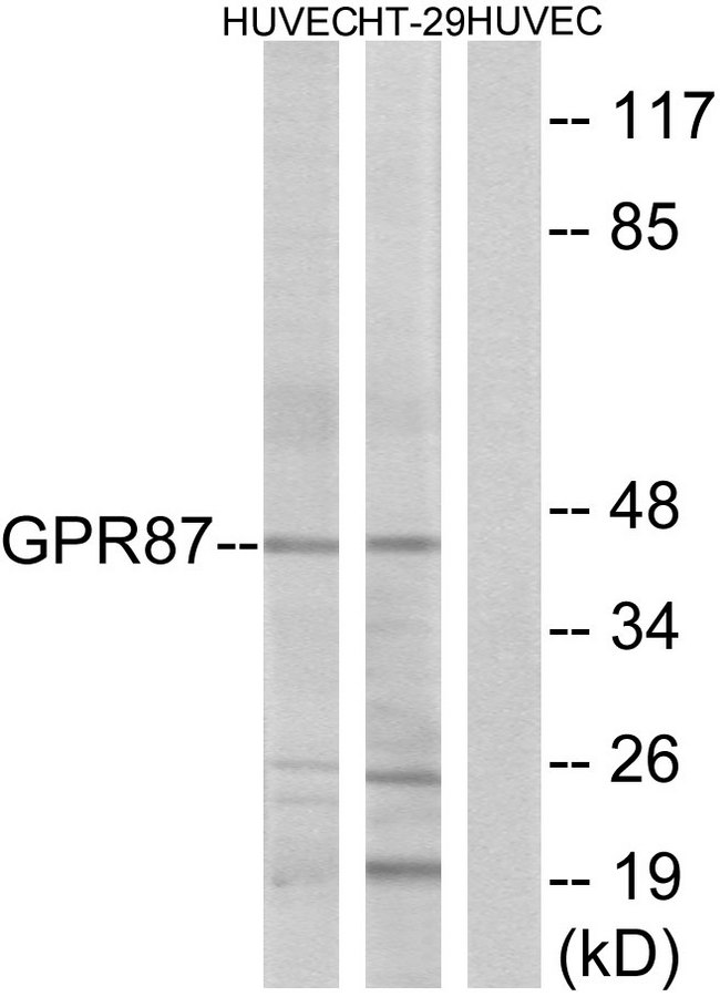 GPR87 Antibody - Western blot analysis of lysates from HUVEC and HT-29 cells, using GPR87 Antibody. The lane on the right is blocked with the synthesized peptide.