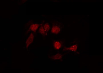 GPR87 Antibody - Staining LOVO cells by IF/ICC. The samples were fixed with PFA and permeabilized in 0.1% Triton X-100, then blocked in 10% serum for 45 min at 25°C. The primary antibody was diluted at 1:200 and incubated with the sample for 1 hour at 37°C. An Alexa Fluor 594 conjugated goat anti-rabbit IgG (H+L) Ab, diluted at 1/600, was used as the secondary antibody.