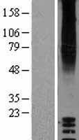 GPR87 Protein - Western validation with an anti-DDK antibody * L: Control HEK293 lysate R: Over-expression lysate