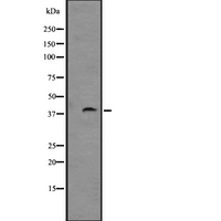 GPR88 Antibody - Western blot analysis of GPR88 expression in rat brain lysate. The lane on the left is treated with the antigen-specific peptide.