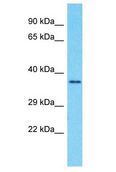 GPR89A Antibody - GPR89A antibody Western Blot of Fetal Brain. Antibody dilution: 1 ug/ml.  This image was taken for the unconjugated form of this product. Other forms have not been tested.