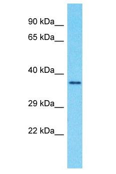 GPR89A Antibody - GPR89A antibody Western Blot of Fetal Brain. Antibody dilution: 1 ug/ml.  This image was taken for the unconjugated form of this product. Other forms have not been tested.