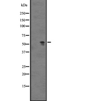 GPR89A Antibody - Western blot analysis of GPR89A expression in human fetal heart lysate. The lane on the left is treated with the antigen-specific peptide.