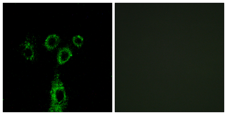 GPRASP1 / GASP-1 Antibody - Immunofluorescence analysis of A549 cells, using GASP1 Antibody. The picture on the right is blocked with the synthesized peptide.