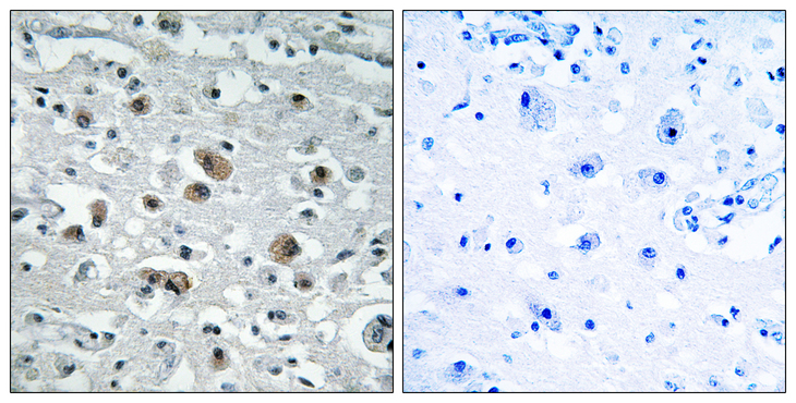 GPRASP1 / GASP-1 Antibody - Immunohistochemistry analysis of paraffin-embedded human brain tissue, using GASP1 Antibody. The picture on the right is blocked with the synthesized peptide.