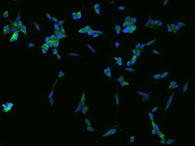 GPRASP1 / GASP-1 Antibody - Immunofluorescence staining of GPRASP1 in SHSY5Y cells. Cells were fixed with 4% PFA, permeabilzed with 0.1% Triton X-100 in PBS, blocked with 10% serum, and incubated with rabbit anti-Human GPRASP1 polyclonal antibody (dilution ratio 1:200) at 4°C overnight. Then cells were stained with the Alexa Fluor 488-conjugated Goat Anti-rabbit IgG secondary antibody (green) and counterstained with DAPI (blue). Positive staining was localized to Cytoplasm.