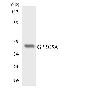 GPRC5A / RAI3 Antibody - Western blot analysis of the lysates from K562 cells using GPRC5A antibody.