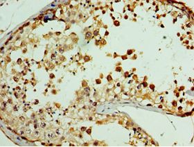 GPRC5A / RAI3 Antibody - Immunohistochemistry of paraffin-embedded human testis tissue using antibody at 1:100 dilution.