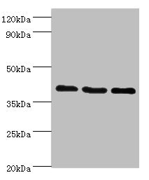 GPRC5A / RAI3 Antibody - Western blot All lanes: GPRC5A antibody at 8µg/ml Lane 1: Hela whole cell lysate Lane 2: HepG2 whole cell lysate Lane 3: MCF-7 whole cell lysate Secondary Goat polyclonal to rabbit IgG at 1/10000 dilution Predicted band size: 40 kDa Observed band size: 40 kDa