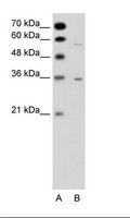 GPRC5A / RAI3 Antibody - A: Marker, B: Jurkat Cell Lysate.  This image was taken for the unconjugated form of this product. Other forms have not been tested.