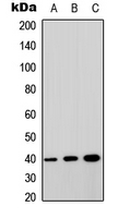 GPRC5A / RAI3 Antibody - Western blot analysis of GPRC5A expression in MCF7 (A); HEK293T (B); NIH3T3 (C) whole cell lysates.