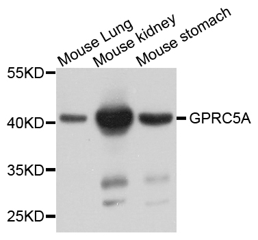 GPRC5A / RAI3 Antibody - Western blot analysis of extract of various cells.