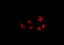 GPRC5A / RAI3 Antibody - Staining K562 cells by IF/ICC. The samples were fixed with PFA and permeabilized in 0.1% Triton X-100, then blocked in 10% serum for 45 min at 25°C. The primary antibody was diluted at 1:200 and incubated with the sample for 1 hour at 37°C. An Alexa Fluor 594 conjugated goat anti-rabbit IgG (H+L) Ab, diluted at 1/600, was used as the secondary antibody.
