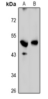 GPRC5C Antibody - Western blot analysis of GPRC5C expression in HEK293T (A), MCF7 (B) whole cell lysates.