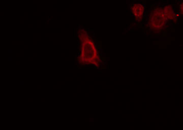 GPRC5C Antibody - Staining RAW264.7 cells by IF/ICC. The samples were fixed with PFA and permeabilized in 0.1% Triton X-100, then blocked in 10% serum for 45 min at 25°C. The primary antibody was diluted at 1:200 and incubated with the sample for 1 hour at 37°C. An Alexa Fluor 594 conjugated goat anti-rabbit IgG (H+L) Ab, diluted at 1/600, was used as the secondary antibody.