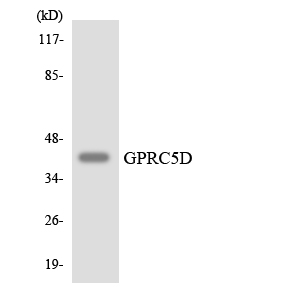 GPRC5D Antibody - Western blot analysis of the lysates from HUVECcells using GPRC5D antibody.