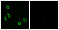 GPRC5D Antibody - Immunofluorescence analysis of MCF7 cells, using GPRC5D Antibody. The picture on the right is blocked with the synthesized peptide.