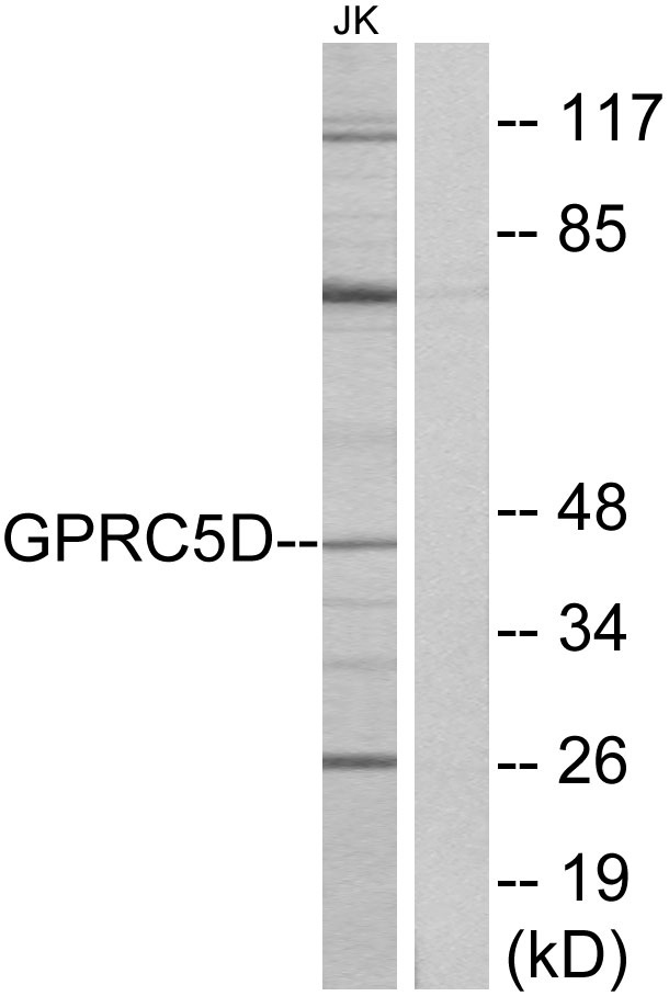 GPRC5D Antibody - Western blot analysis of lysates from Jurkat cells, using GPRC5D Antibody. The lane on the right is blocked with the synthesized peptide.