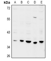 GPRC5D Antibody - Western blot analysis of GPRC5D expression in MCF7 (A), SGC7901 (B), Panc1 (C), CT26 (D), PC12 (E) whole cell lysates.