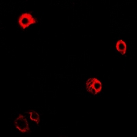 GPRC5D Antibody - Immunofluorescent analysis of GPRC5D staining in MCF7 cells. Formalin-fixed cells were permeabilized with 0.1% Triton X-100 in TBS for 5-10 minutes and blocked with 3% BSA-PBS for 30 minutes at room temperature. Cells were probed with the primary antibody in 3% BSA-PBS and incubated overnight at 4 °C in a hidified chamber. Cells were washed with PBST and incubated with Alexa Fluor 647-conjugated secondary antibody (red) in PBS at room temperature in the dark.