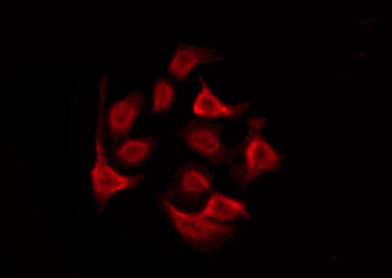 GPRC5D Antibody - Staining HeLa cells by IF/ICC. The samples were fixed with PFA and permeabilized in 0.1% Triton X-100, then blocked in 10% serum for 45 min at 25°C. The primary antibody was diluted at 1:200 and incubated with the sample for 1 hour at 37°C. An Alexa Fluor 594 conjugated goat anti-rabbit IgG (H+L) Ab, diluted at 1/600, was used as the secondary antibody.