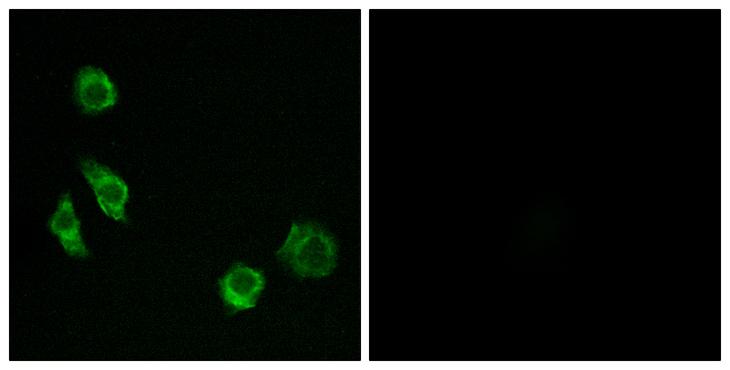 GPRC5D Antibody - Peptide - + Immunofluorescence analysis of MCF-7 cells, using GPRC5D antibody.