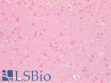 GPRC5D Antibody - Human Brain: Formalin-Fixed, Paraffin-Embedded (FFPE)