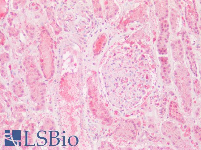 GPRC5D Antibody - Human Kidney: Formalin-Fixed, Paraffin-Embedded (FFPE)