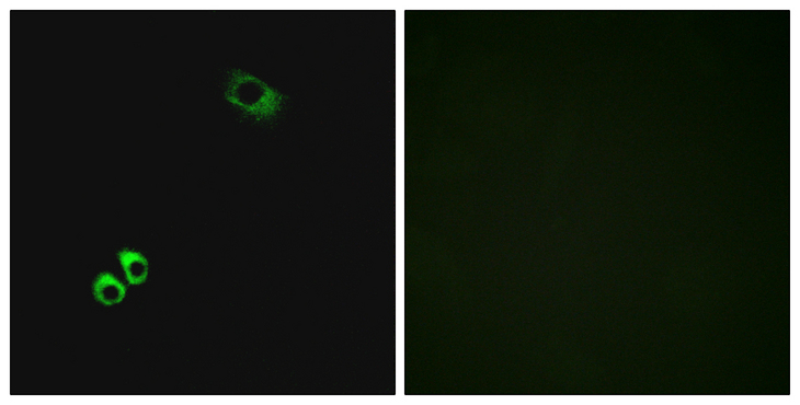 GPRC6A Antibody - Immunofluorescence analysis of MCF7 cells, using GPRC6A Antibody. The picture on the right is blocked with the synthesized peptide.