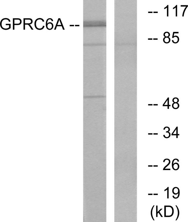 GPRC6A Antibody - Western blot analysis of lysates from Jurkat cells, using GPRC6A Antibody. The lane on the right is blocked with the synthesized peptide.