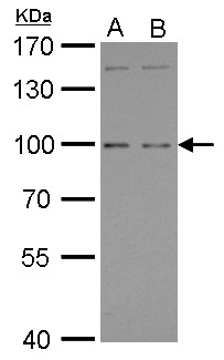 GPRC6A Antibody - GPRC6A antibody [C3], C-term detects GPRC6A protein by Western blot analysis. A. 30 ug Raji whole cell lysate/extract. B. 30 ug K562 whole cell lysate/extract. 7.5 % SDS-PAGE. GPRC6A antibody [C3], C-term dilution:1:500