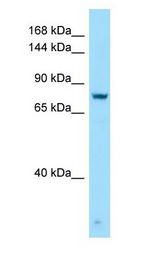 GPRC6A Antibody - GPRC6A antibody Western Blot of Jurkat.  This image was taken for the unconjugated form of this product. Other forms have not been tested.
