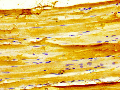 GPRC6A Antibody - Immunohistochemistry image at a dilution of 1:400 and staining in paraffin-embedded human skeletal muscle tissue performed on a Leica BondTM system. After dewaxing and hydration, antigen retrieval was mediated by high pressure in a citrate buffer (pH 6.0) . Section was blocked with 10% normal goat serum 30min at RT. Then primary antibody (1% BSA) was incubated at 4 °C overnight. The primary is detected by a biotinylated secondary antibody and visualized using an HRP conjugated SP system.