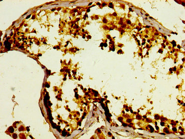 GPRC6A Antibody - Immunohistochemistry image at a dilution of 1:400 and staining in paraffin-embedded human testis tissue performed on a Leica BondTM system. After dewaxing and hydration, antigen retrieval was mediated by high pressure in a citrate buffer (pH 6.0) . Section was blocked with 10% normal goat serum 30min at RT. Then primary antibody (1% BSA) was incubated at 4 °C overnight. The primary is detected by a biotinylated secondary antibody and visualized using an HRP conjugated SP system.
