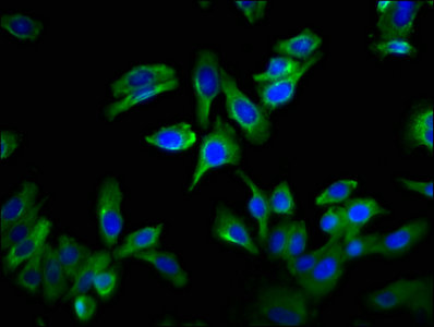 GPRC6A Antibody - Immunofluorescence staining of HepG2 cells with GPRC6A Antibody at 1:133, counter-stained with DAPI. The cells were fixed in 4% formaldehyde, permeabilized using 0.2% Triton X-100 and blocked in 10% normal Goat Serum. The cells were then incubated with the antibody overnight at 4°C. The secondary antibody was Alexa Fluor 488-congugated AffiniPure Goat Anti-Rabbit IgG(H+L).