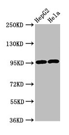 GPRC6A Antibody - Western Blot Positive WB detected in: HepG2 whole cell lysate, Hela whole cell lysate All lanes: GPRC6A antibody at 4.7µg/ml Secondary Goat polyclonal to rabbit IgG at 1/50000 dilution Predicted band size: 105, 85, 97 kDa Observed band size: 97 kDa